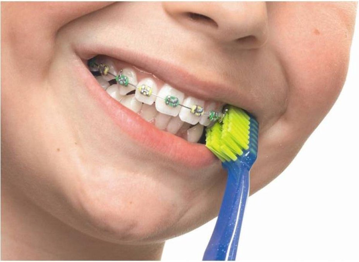 Curaprox Tandenborstel Ultra Soft Ortho Per stuk