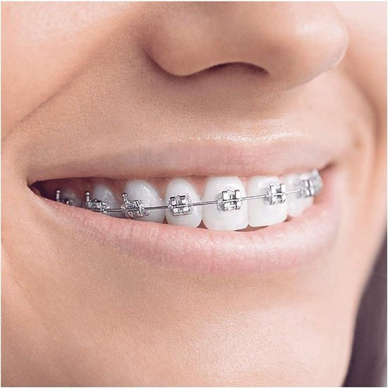 Oral B Oral-b Smartseries Teen - Elektrische Tandenborstel - Wit