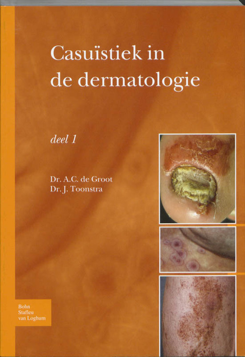 Bohn Stafleu Van Loghum Casuïstiek in de dermatologie