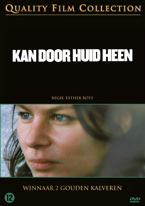 A Film Benelux Msd B.v. Kan Door Huid Heen