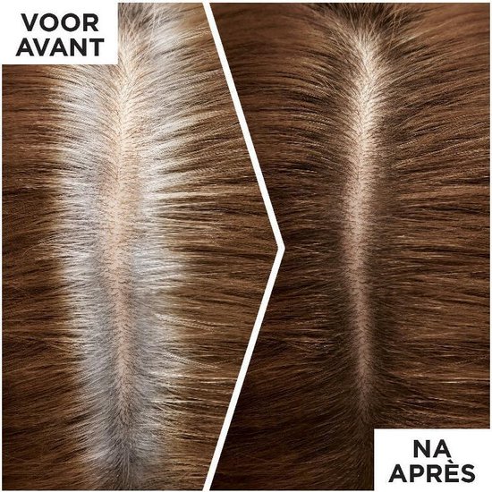 Loréal Paris Uitgroei Spray - Magic Retouch Midden 75 ml - Bruin