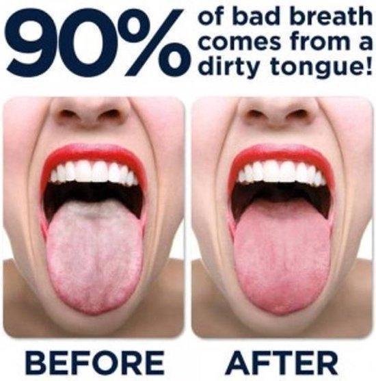 Maharishi Ayurveda Tongschraper Rv Staal Mtc Bestekoop Per stuk