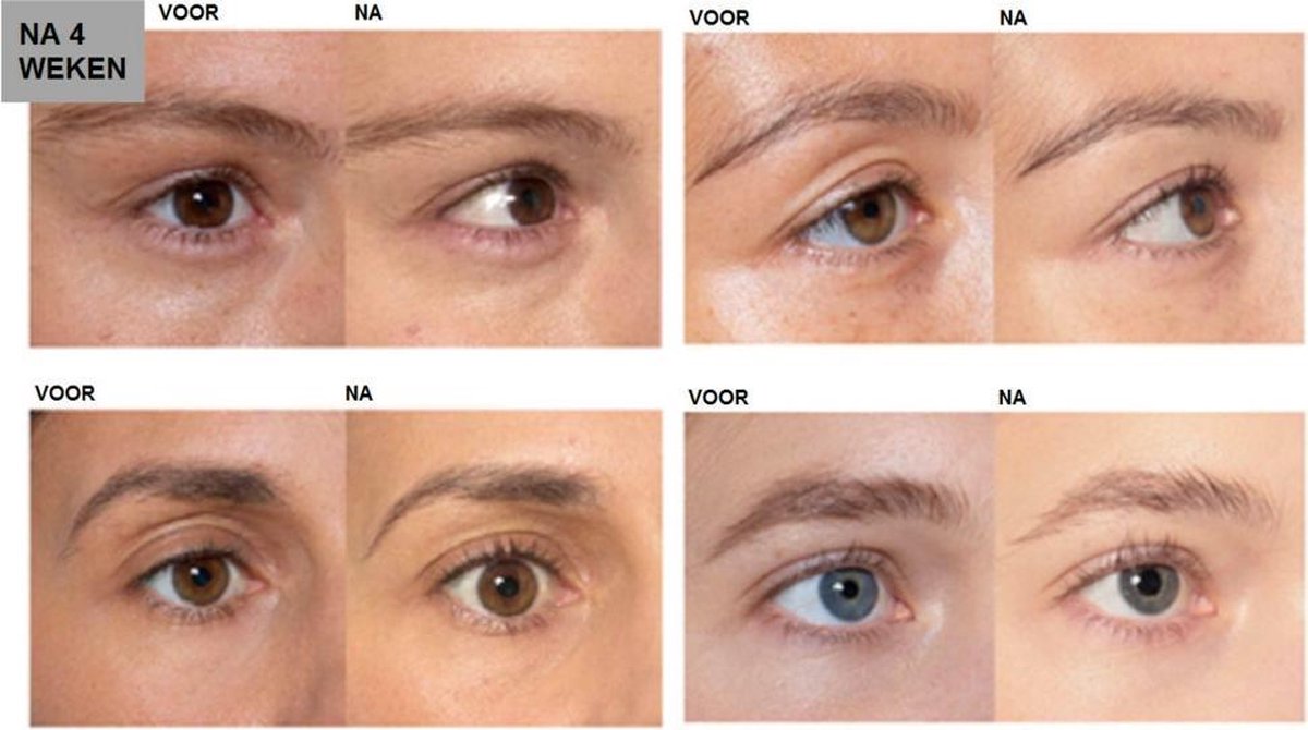 L'Oreal Paris L´Oréal Paris Clinically Proven Lash Serum Wimperverzorging 1.4 ml