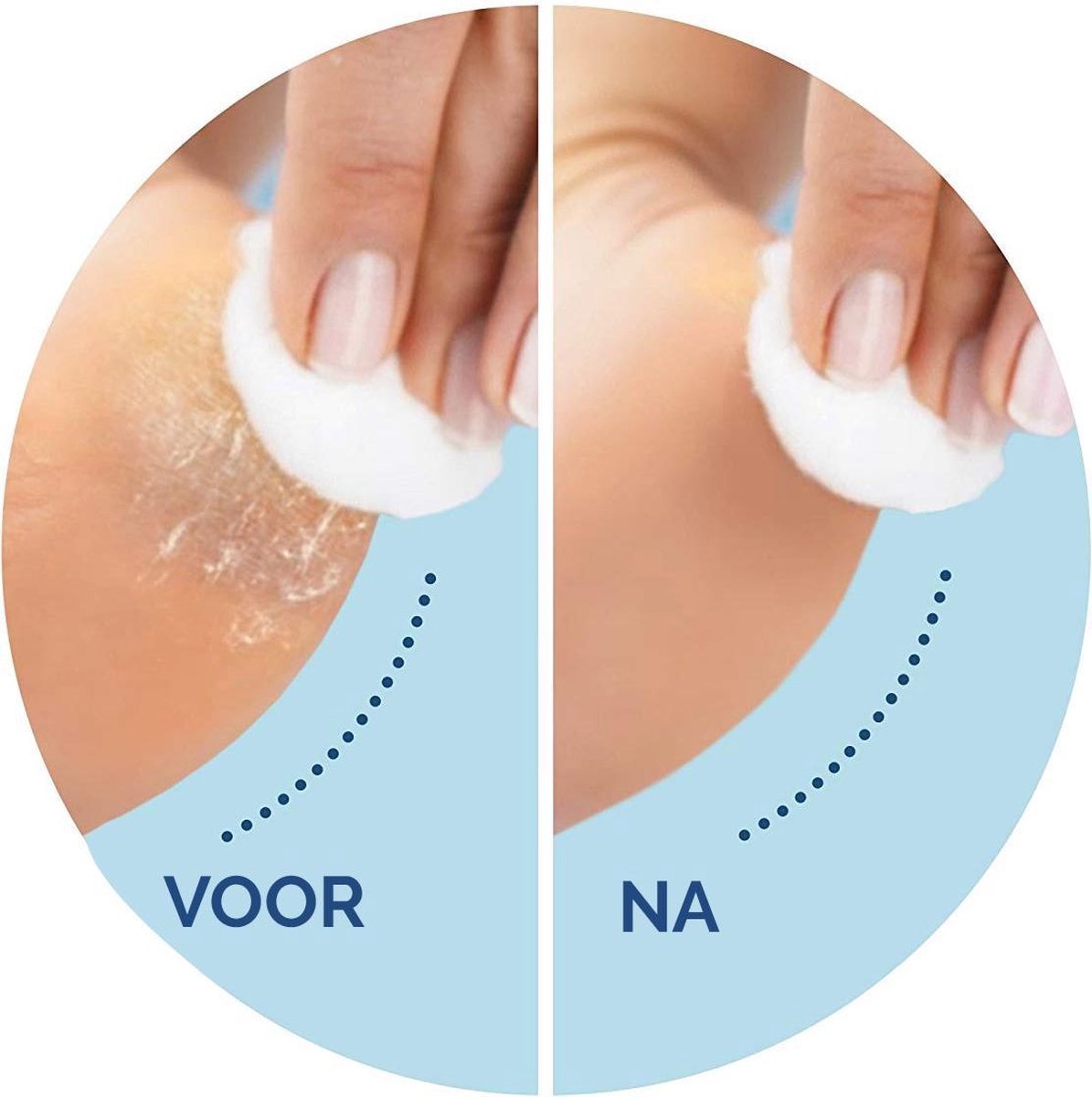 Scholl Voetvijl - Navulling Velvet Smooth - Ultra Harde Huid - 2 Stuks