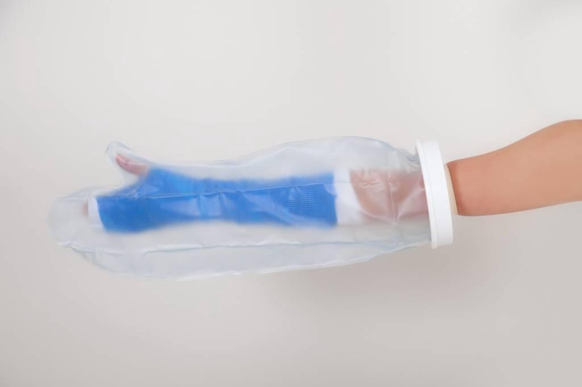 Able2 Gipshoes Halve Arm Volwassene