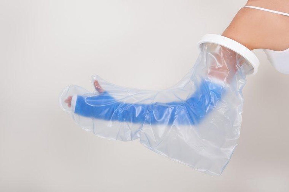 Able2 Gipshoes Hele Arm Volwassene