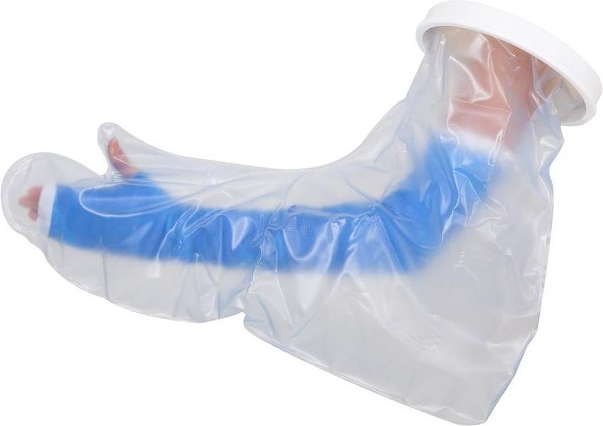 Able2 Gipshoes Hele Arm Volwassene